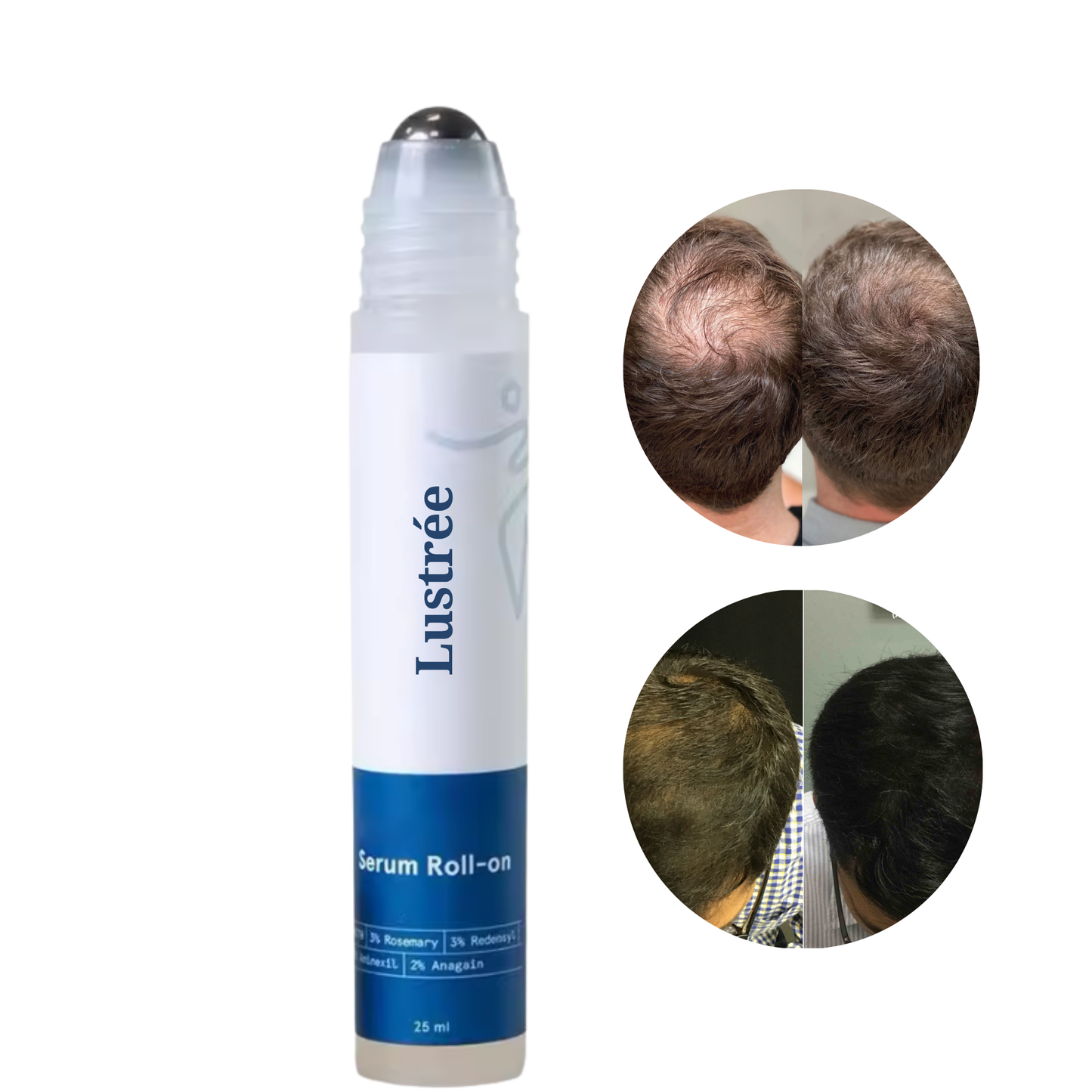 Patented Roll-On Serum Promoting Hair Growth